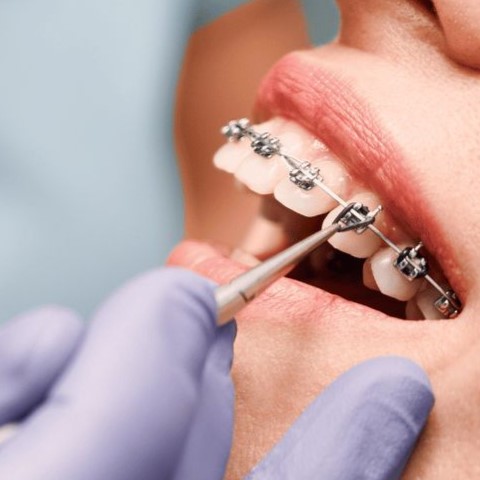 Family dental care highlights